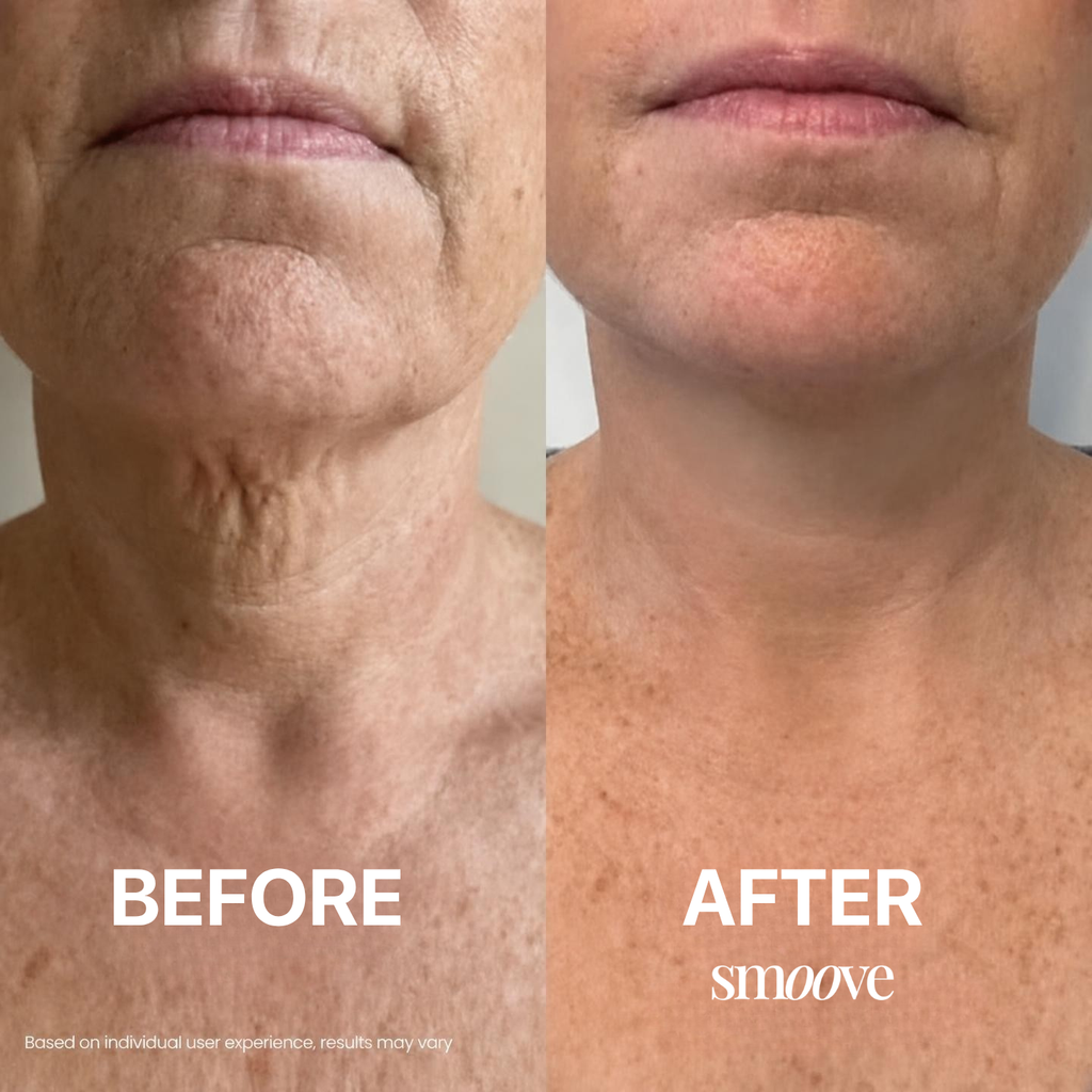 Smoove®️ Tighten & Lift Neck Cream