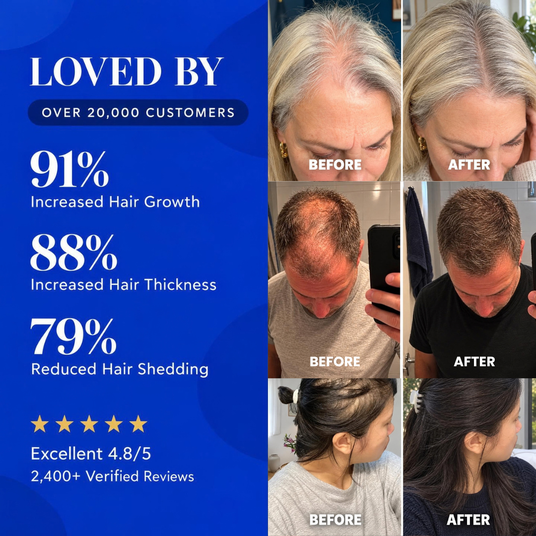 Smoove Hair Growth Roll on Serum