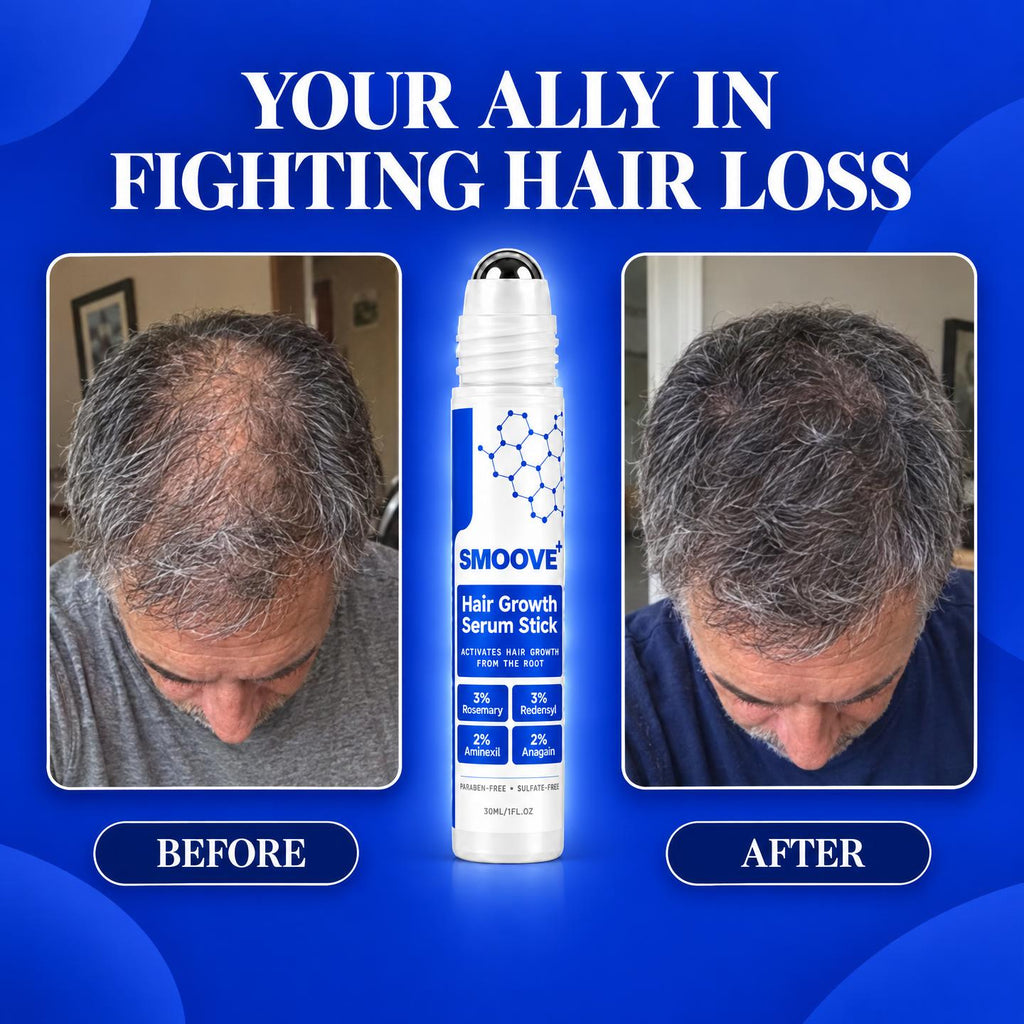 Smoove Hair Growth Roll on Serum