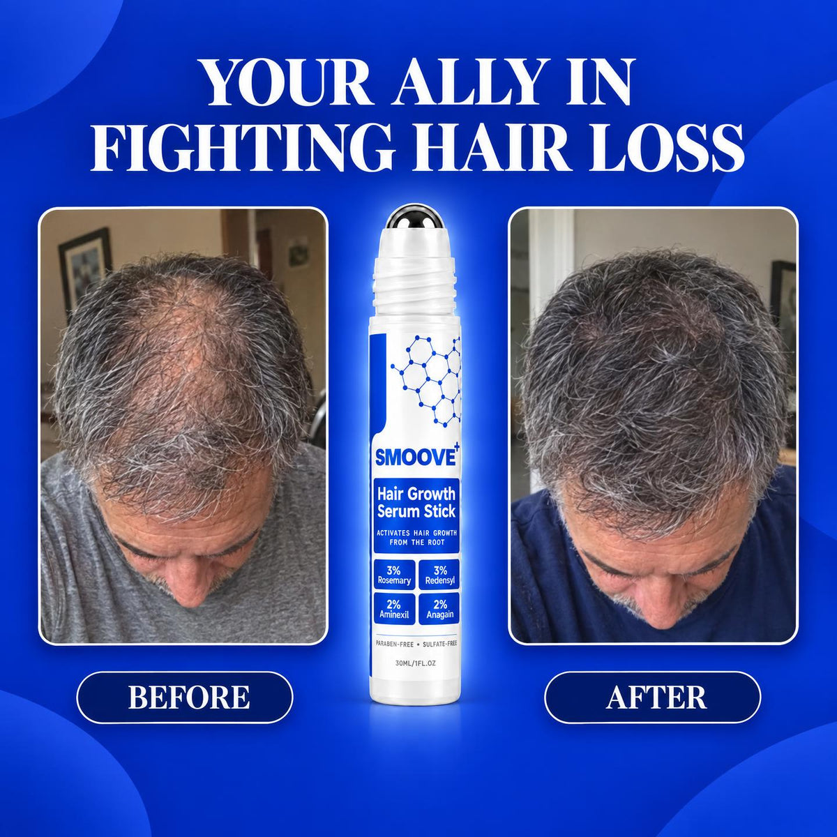 Smoove Hair Growth Roll on Serum