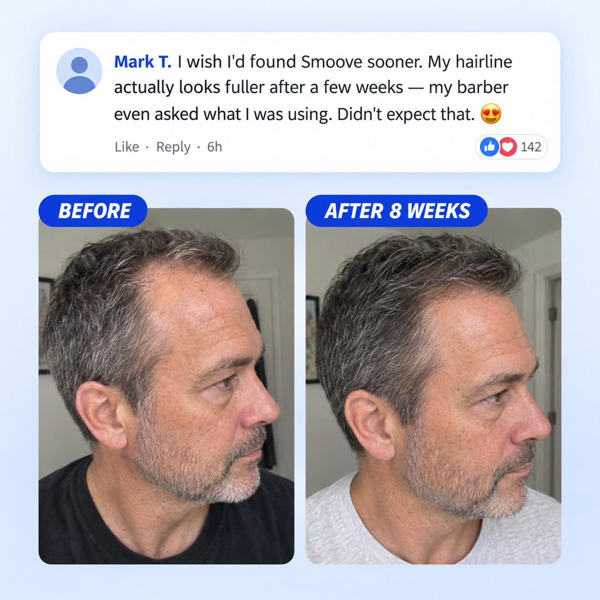 Smoove Hair Growth Roll on Serum